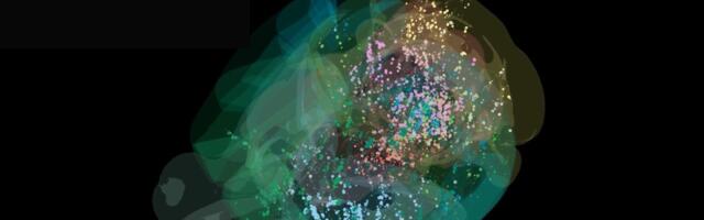 This Is the First Time Scientists Have Seen Decisionmaking in a Brain