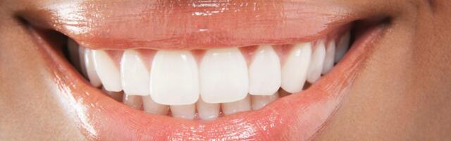 The Best Whitening Toothpastes Dentists Recommend to Their Patients