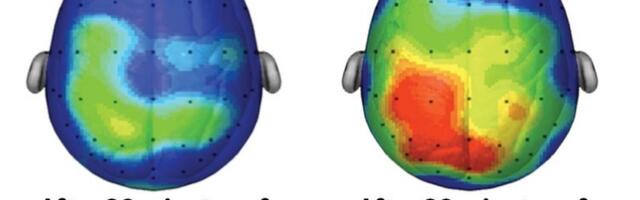 Your brain after sitting down for 20 minutes vs walking for 20 minutes, research findings will shock you