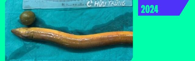 The Weirdest Medical Cases of 2024