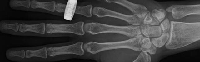 Behold: The First Medical X-rays Ever Taken in Space