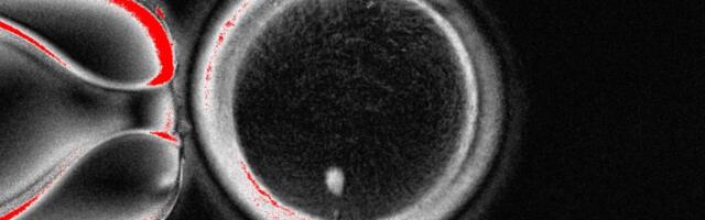 Scientists Made Human Eggs from Skin Cells and Used Them to Form Embryos