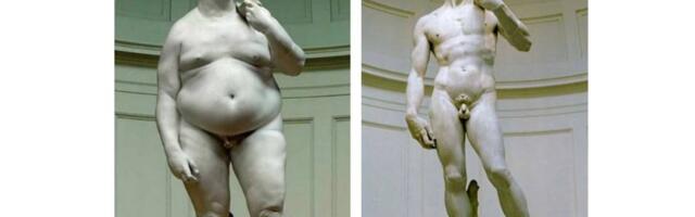 Три истории пациентов с лишним весом: как процедура ESG меняет жизнь