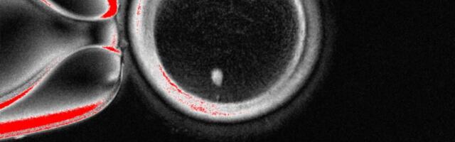 Biologists Turn Skin Cells Into Human Eggs in Groundbreaking Experiment