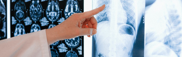AI imaging database for COVID-19 diagnosis provided to UK hospitals