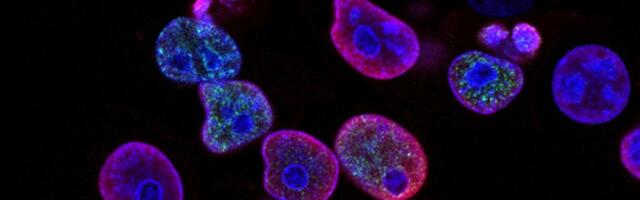 Austria's Sarcura raises €7 million to bring "cutting-edge silicon" to cell therapy manufacturing