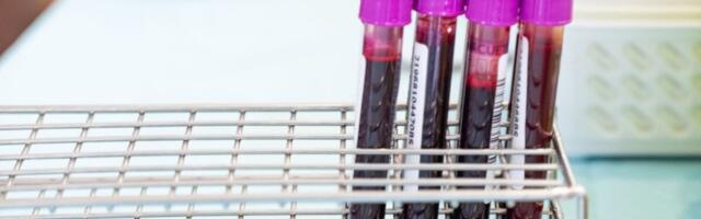 A Simple Blood Test Could Eventually Tell You When Alzheimer’s Is Coming