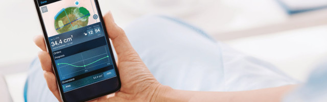 Swift Medical secures $44 million CAD in Series B financing