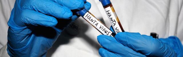 All Your Hantavirus Questions, Answered by an Infectious Disease Expert