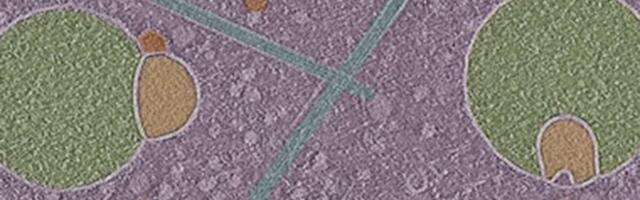 Biologists Uncover Previously Unknown Structure Hiding Inside Human Cells