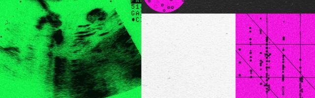 Designer Baby Companies Are in Turmoil