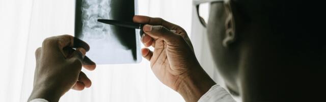 AI hospital scans could help detect broken bones in England