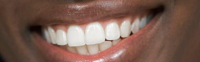 Coffee or Wine Staining Your Pearly Whites? A Dentist Offers Teeth Tips to Prevent This