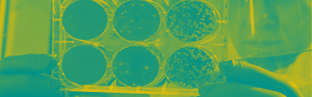How do we improve cybersecurity? By copying our body’s immune system