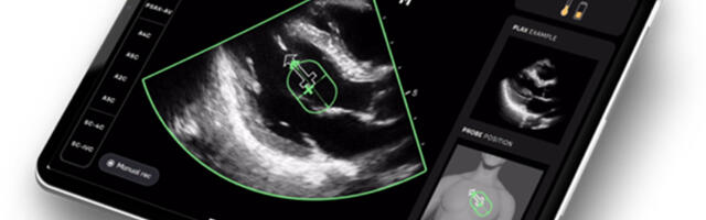 French startup DESKi raises $6M to prevent cardiac disease with AI-powered heart scans