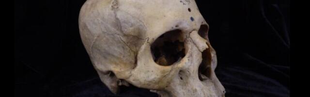 Ancient Egyptian skull shows evidence of cancer, surgical treatment