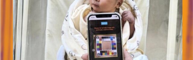 This AI app lets parents look for signs of infant jaundice at home