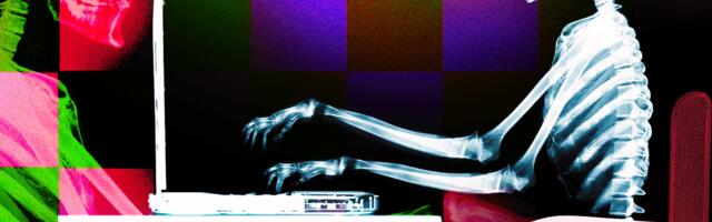 How to Prevent Tech Neck and Sit Properly With Your Laptop (2025)