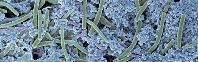 Mesosil’s infection-fighting dental tech gets FDA clearance