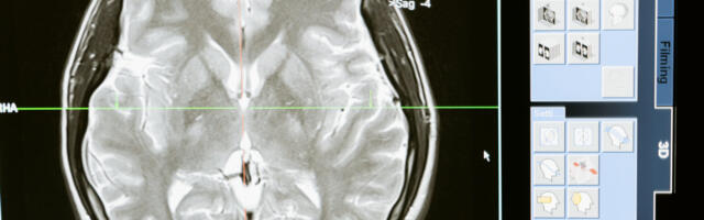 Trinity to host new research on how immune system repairs brain