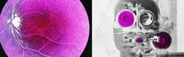 Longevity Startup Doses First Human in Bid to Reverse Age-Related Sight Loss