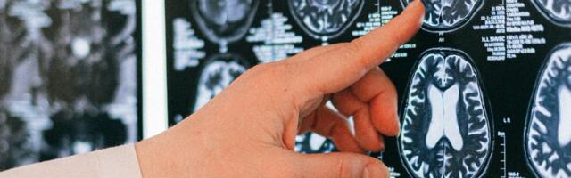 UK-based QV Bioelectronics raises £2 million for potential brain tumour treatment