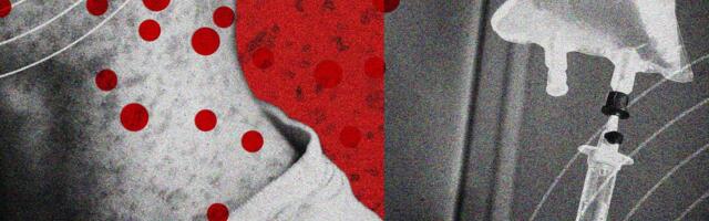 Measles Is Becoming So Common That Treatments May Soon Be Needed