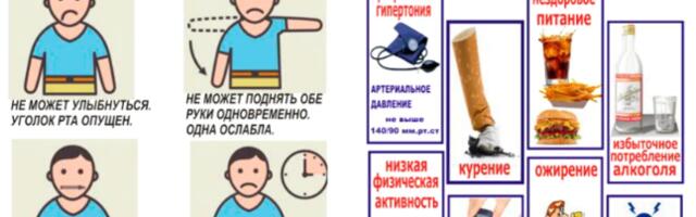 Инсульт — это не только УДАР. Инструкция для всех