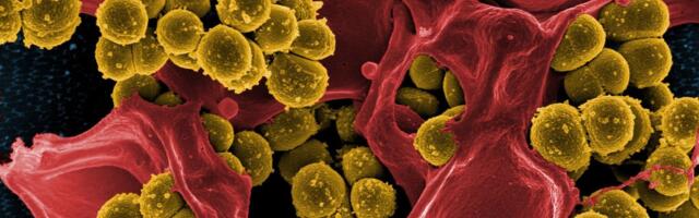 Hospital Sink Drains are a Total Horror Show of Germs