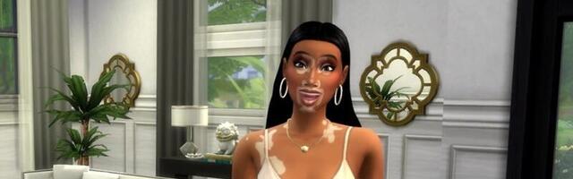 Free Sims 4 update adds Vitiligo skin details with Winnie Harlow collaboration