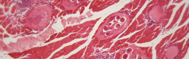 Tainted Beef Jerky Caused an Outbreak of Bear Worms