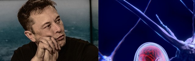 Elon Musk’s Neuralink is being outperformed by this Spanish graphene startup