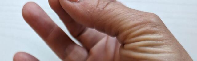 The Chef's Hand Trick for Knowing Exactly When Your Steak Is Done