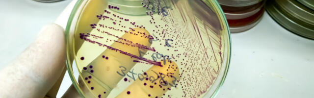 Researchers engineer bacteria to produce plastics