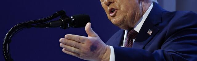 Just how healthy is Donald Trump, really?