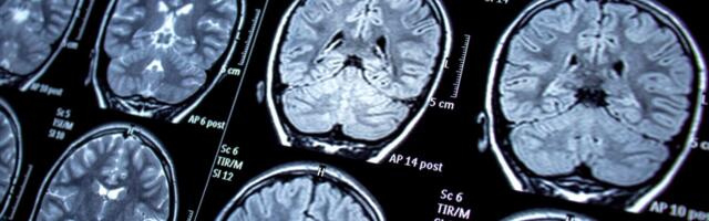 Your Brain Data Is for Sale, Senators Warn