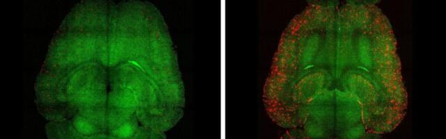 Scientists Just Reversed Alzheimer’s in Mice. Could They Do It in Humans?