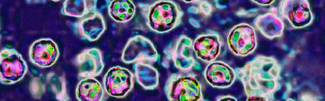 The US Is In For Another Bad Year of Measles Cases