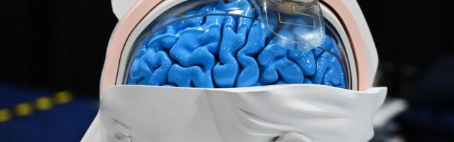 The brain tech revolution is here — and it isn’t all Black Mirror
