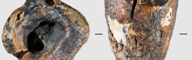 Neanderthal Dentists Treated Cavities With Stone Drills. Yes, Really