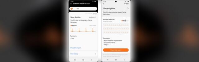 Samsung Health Monitor drops support for Android 11 and earlier versions