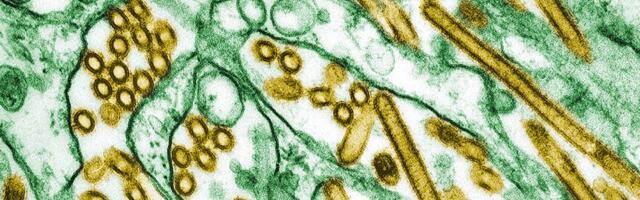 CDC Confirms First US Case of Severe Bird Flu