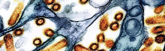 California raw milk recalled after positive test for bird flu virus