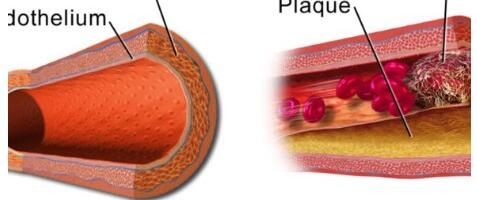 Тонкая нить жизни: новая теория предсказывает архитектуру тромбов на языке физики