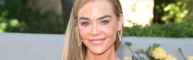 The facelift is going mainstream, and Denise Richards is proof