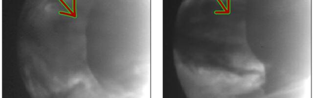 A Gigantic Atmospheric Anomaly Keeps Showing Up on Venus. Astronomers Finally Know Why