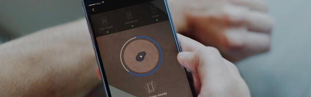 Spot Skin Cancer With Your Smartphone With These 3 Apps