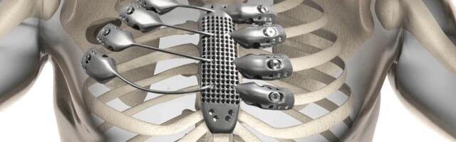 SLM 3D Printing in Medicine