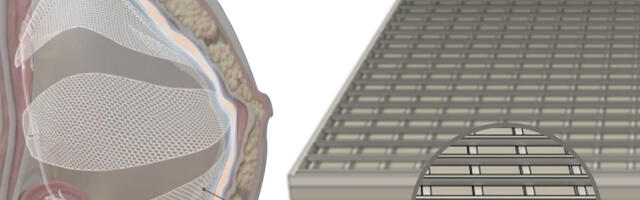 Custom-Printed Healing: Exploring PLCOSKIN’s TissueDerm for Enhanced Tissue Regeneration