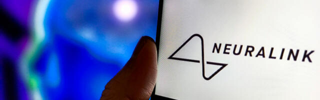 Neuralink: что известно на данный момент